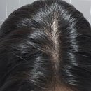 풍성한 머릿결을 위한 두피케어 | 로블루 약산성 샴푸 후기 비건인증 두피케어