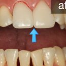 연세좋은치과기공소 이미지