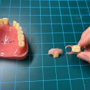 샘치과기공소 이미지