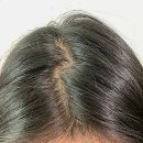 케이메디텍 | [뷰티] 빠지는 머리카락 절대사수 몬퓨리엘 헤어토닉 두피열내려주기