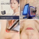 파라핀해독샵 | 목동 오목교 피부관리 잘하는곳 뷰티엔젤의 5세대 MTS 이젝션 후기