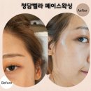 청담-146 | 논현역왁싱샵 청담벨라 | 직접 받아본 무통왁싱 솔직후기