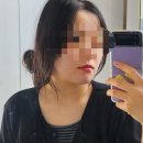 올리브피부과의원 | 턱 여드름 반복 원인 찾다가 톤즈의원 방문한 이유 내돈내산 피부과 상담 후기(1탄)