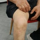 바른의수족제작연구소 이미지