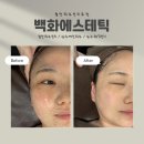 첨단피부관리 광주웨딩관리 추천 백화에스테틱 아르케 수분물광관리 후기