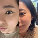 원에디션강남 피부관리 예쁘다 강남 에스테틱 강남 웰니스 건강검진센터 내 있어요💆🏻‍♀️