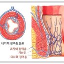 (혐오) 치질을 가지신분은 꼭 보세요 이미지