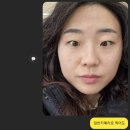 아이미즈산부인과의원 | 노원 피부과 미즈아이 토닝레이저 후기