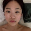 UR(파주시)-[소리천로]-상-7 | 파주피부관리 잘하는곳 리데이 에스테틱에서 윤곽 리프팅 받은 후기