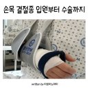 세븐일레븐 대구W병원점 | 손목 물혹 결절종 w병원 수술 입원 후기