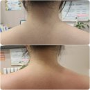 성진기기 | 서면 경락관리 엘라샵 등관리 받고 온 후기