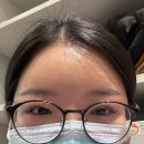 이마로 | [내돈내산] 이마필러 후기😜