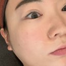마곡U테라피 | 오래다닐 가양에스테틱 추천 미플 가양점 3회차 재방문 후기