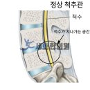 세호한의원 | 협착증, 첨단 장비와 추나 치료로 통증 없는 일상 되찾기 (충남 당진 세호한의원)