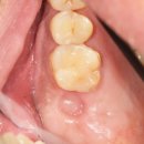 애플치과기공소 이미지