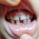 개구쟁이치과의원 이미지