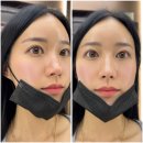 매곡중학교 | [울산 매곡] 속눈썹맛집 아이참예뻐 두번째방문 후기