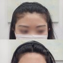 라인헤어 이미지