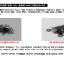 내 안에 세균 있다, 그것도 3~4㎏이나(중앙선데이)/항염차抗炎茶, 비채담 황토 삼백초(향기와 빛명상이 있는 그림찻방)/스케치북 - 윤종신,김장훈 이미지