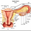 여의사,신촌산부인과 ㅣ여성질환.. 자궁경부암이 뭘까? 발생원인은?? 이미지