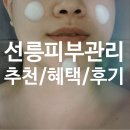 팅커벨 | [공지] [선릉역 에스테틱 추천] 웨딩 예신 관리, 라피네 스킨앤바디 팅커벨 후기