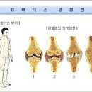 ◑ 뼈에 금이 갔을 때 좋은 음식 ◑ 이미지