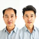 메이크라라헤어라인탈모두피전문 | 목포가발수선 광주가발수선 전문점