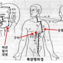 열에 의한 잇몸 질환 이미지