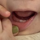 딸기엄마양파아빠 | 육아일기:: 9개월 이야기 ('아빠,엄마,맘마', 후기이유식 3끼, 간식, 이유식 거부..어린이집 입소, 감기...