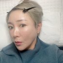 꽉찬두피