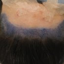 부산 맘모스헤어라인의원 이미지