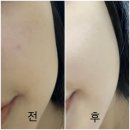 어반약국 | 어반퓨어 세이프서드 페이셜 비누 클렌징 비누 솔직 후기✨