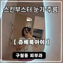 이노 스킨케어 | 구월피부과 스킨부스터 쥬베룩아이 눈가주름 찐 시술후기 내돈내산