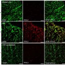 Re:다발성 경화증의 원인은 미토콘드리아 기능부전 - nature 논문 읽어야 이미지