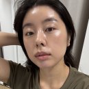 (주)부스터 - 군산시 | 압구정 오퍼스 피부과 리쥬란보다 좋았던 올리디아 콜라겐스킨부스터 후기 (엠보/통증/가격)
