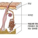 갑자기 겨드랑이 냄새 제거 다한증 암내 시큼한 땀냄새 해결법 이미지