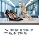에이치제이생활건강 | 흑석동 정형외과: 구두나 하이힐이 불편하다면? 무지외반증 체크!