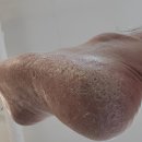 닥터아이티엔발톱깎이 이미지