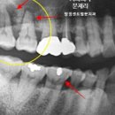 탕정센트럴문치과의원 네이버블로그