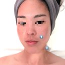 신협프라자 | 대전 관저동 [끌리메 관저점 작은얼굴관리 후기] 윤곽관리 맛집 / 12월 와르르 쏟아지는 이벤트