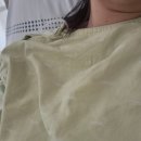 서울삼성수가정의학과 | 건강검진에 소홀하지 말자! 유방 상피내암 발견부터 수술까지, 미세석회화, 부분절제, 삼성서울병원