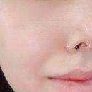 에이씨피원