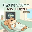 손톱세운고양이 | [시험관 1차 19편] 자궁내막 5.38mm, 그래도 배아 이식 했습니다