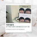 이루리뷰티 - 중구 오류로 31 | [동탄] 동탄두피 이루리뷰티 솔직후기