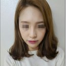 삼성드림이비인후과 네이버블로그