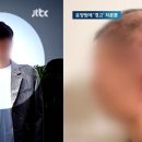 "온갖 일 다 시켜"…20대 요양원 공익, 한 달 만에 온몸 털 다 빠졌다 이미지