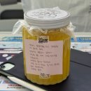 쮸쮸빵빵 | 난소낭종 제거수술 후기 ② | 명지병원 , 입원~퇴원기 , 복강경 로봇수술 , 20대