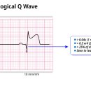V6 의 QS wave 의 예 이미지