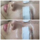 맑은샘피부관리실 | 의왕피부관리 더맑은스킨의왕내손점 CC필로 칙칙한 피부톤 개선 후기