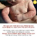 체인지스킨 이미지